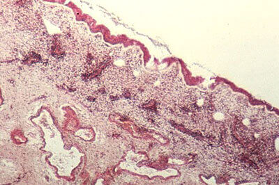 Histologischer Schnitt - Schwellkörper der Nasenmuschel